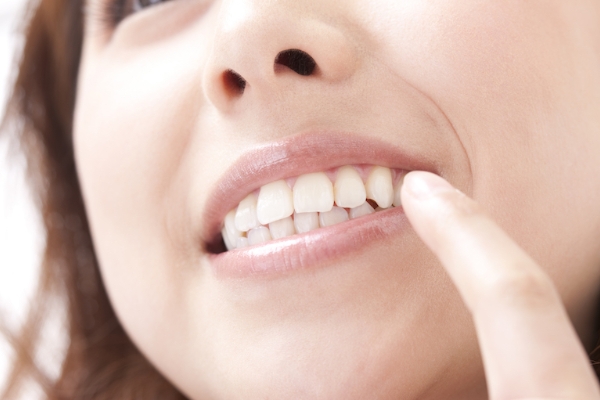 歯の色はお顔の印象を左右します