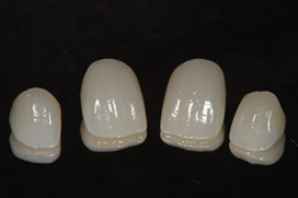 オールセラミック